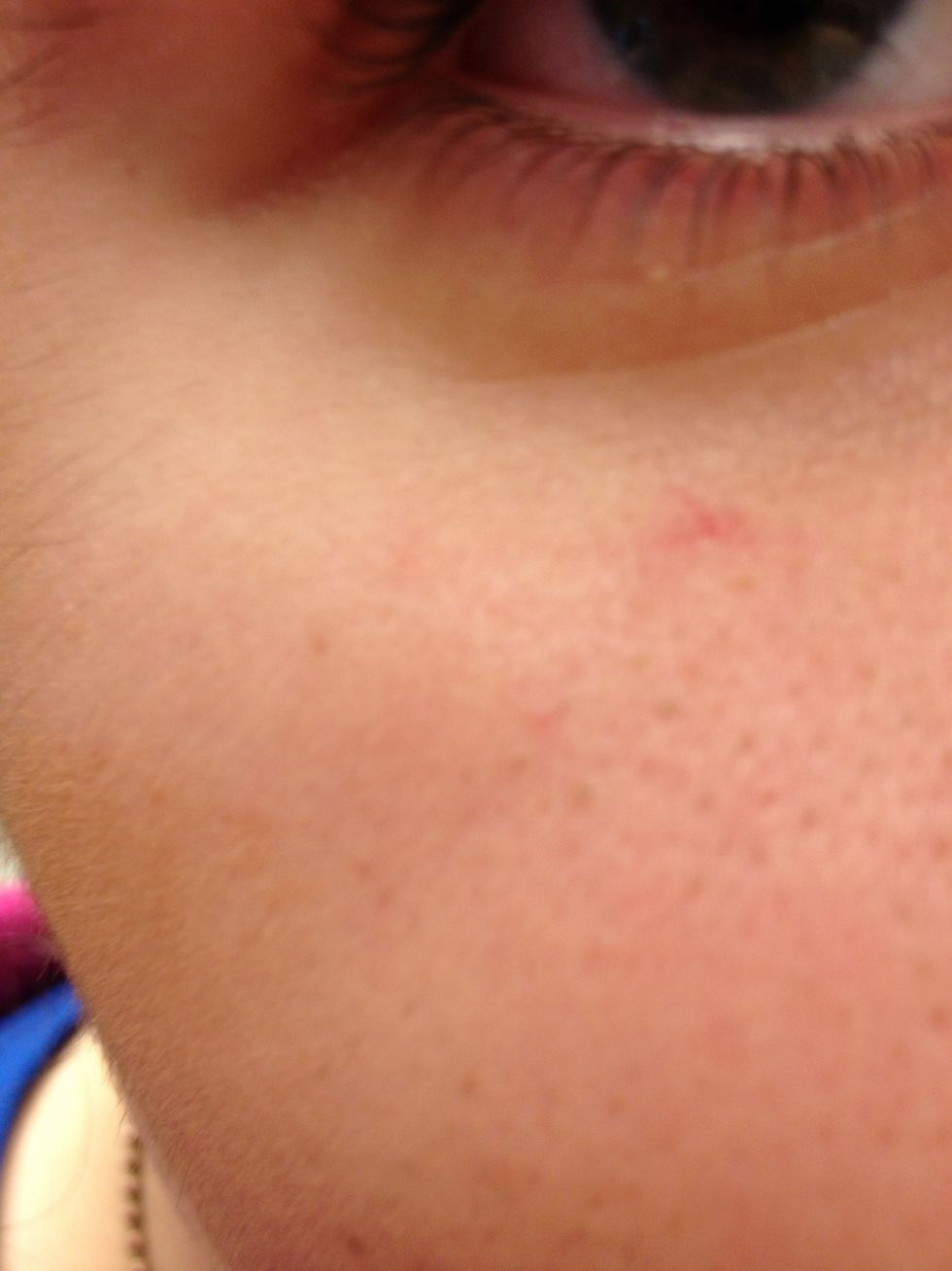 Add bronzer to any marks or blemishes on your skin that you wouldn't want to be seen.