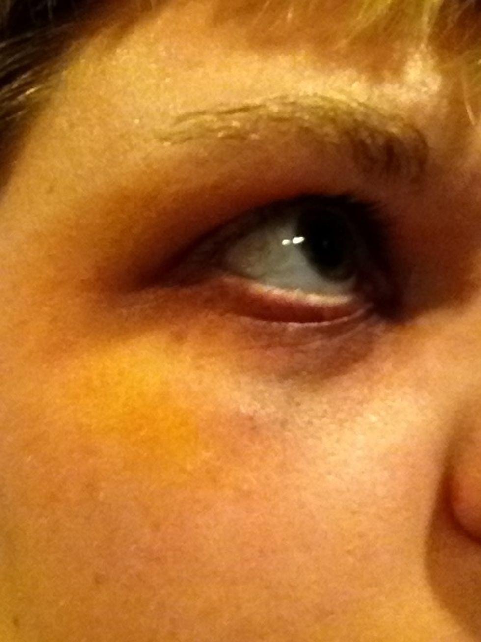 Add yellow to to side (usually on your cheek bone and a little above your eye. For a newer bruise don't use so much yellow. Use the green between the yellow and your eye. Don't use a lot of green.