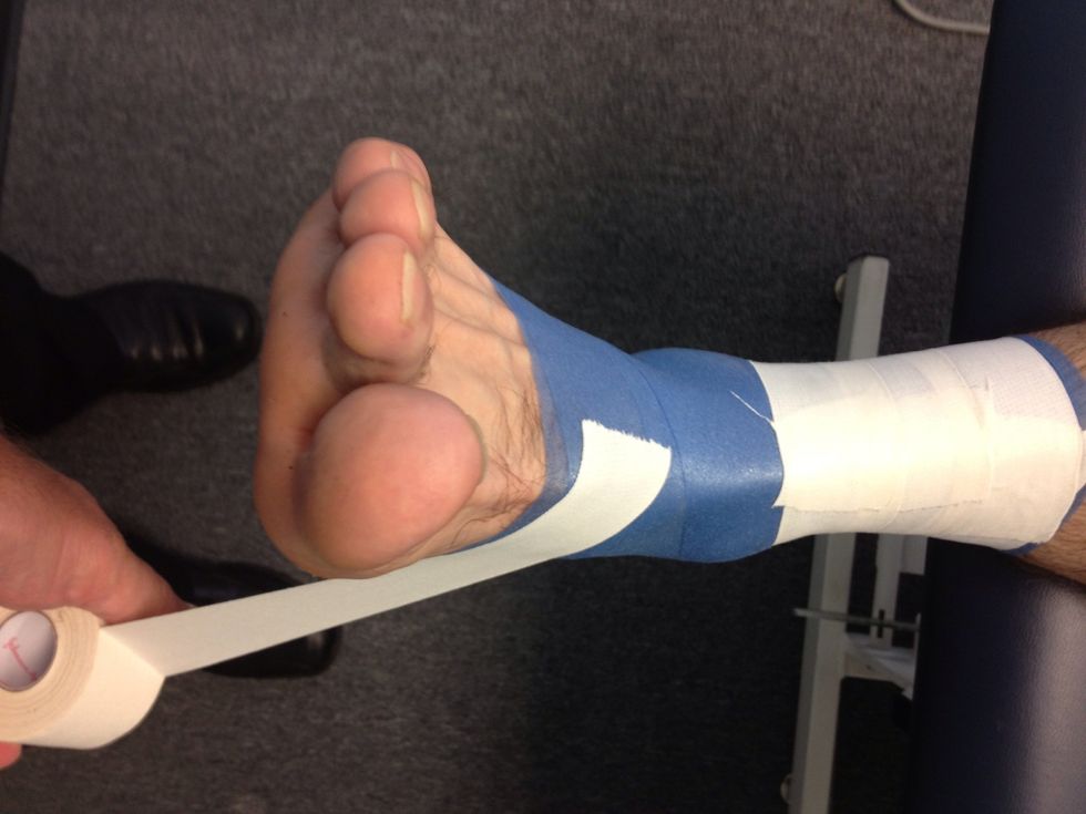 After completing 2-3 top anchors complete one bottom anchor around the foot.