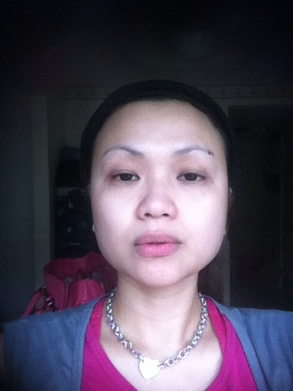 After I washed out all the eggs already. Check out my eyelids, much more pulled not looking like I have extra skin dropping.