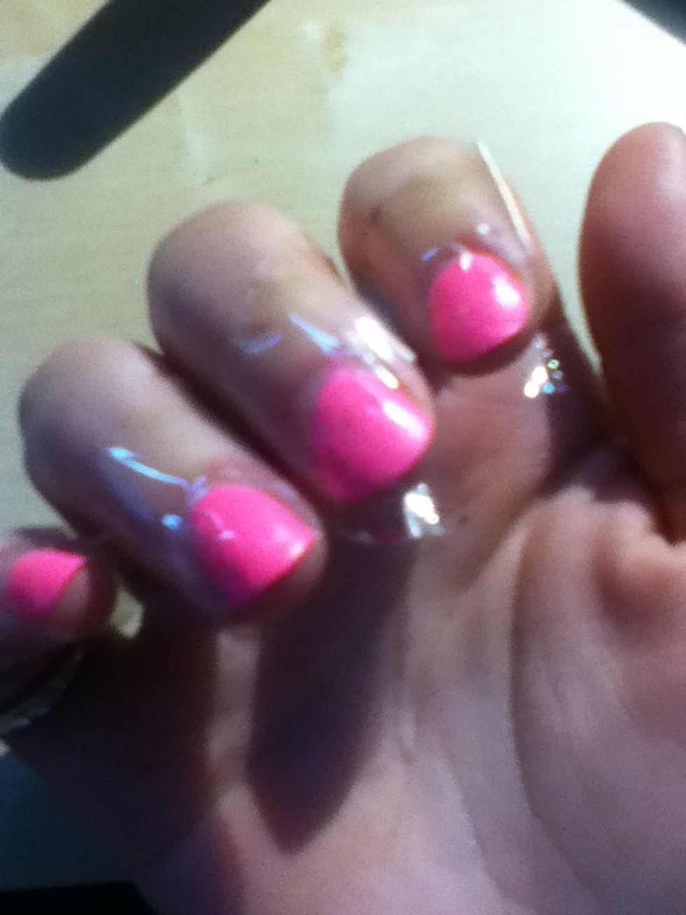 All my fingers cellotaped