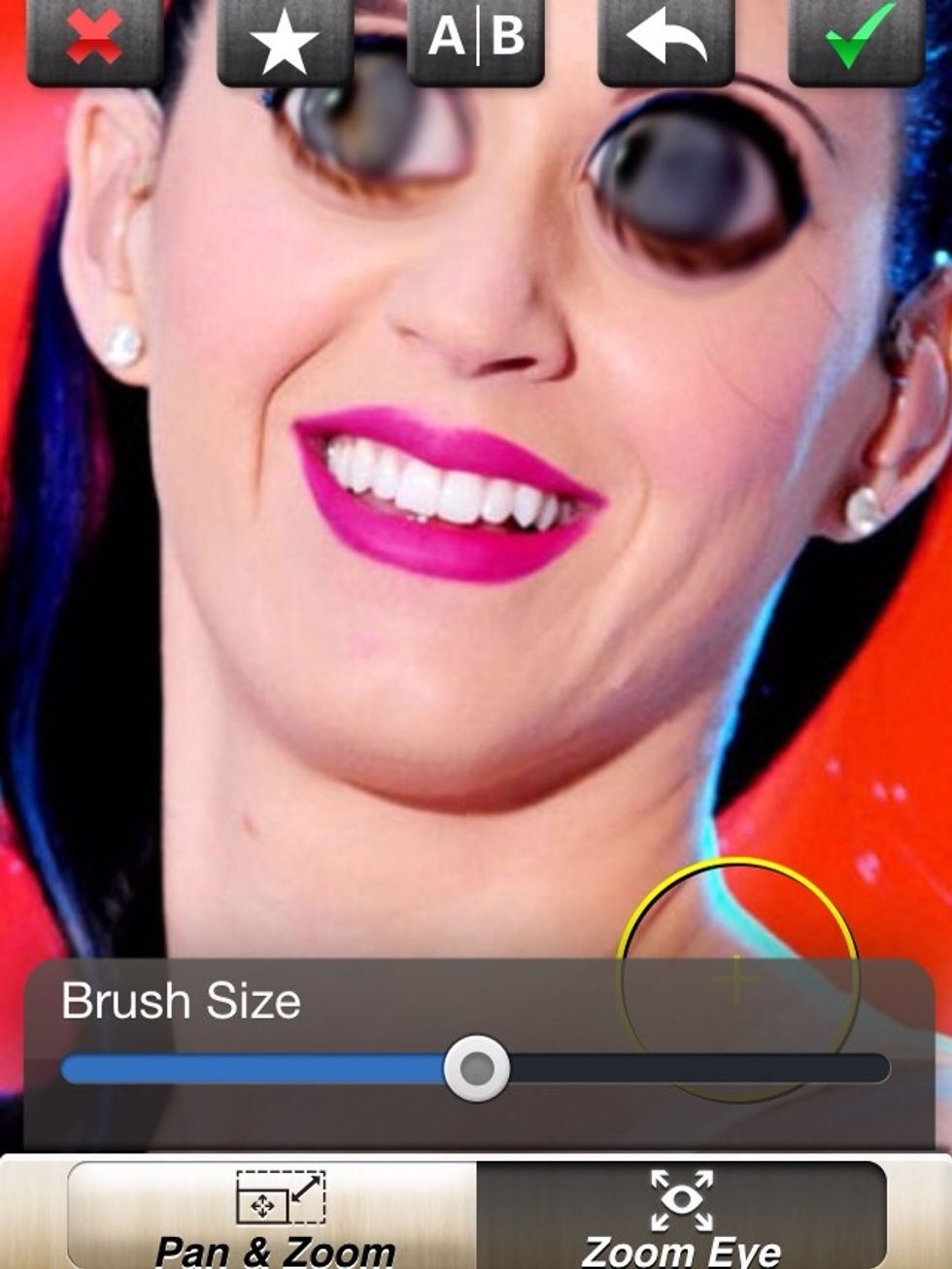 And do the other eye