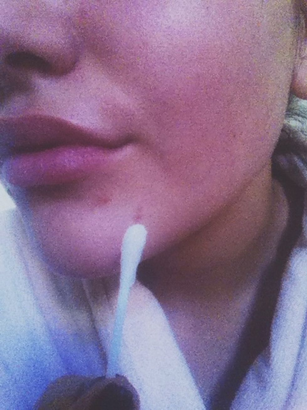 Apply the mixture on your zits.