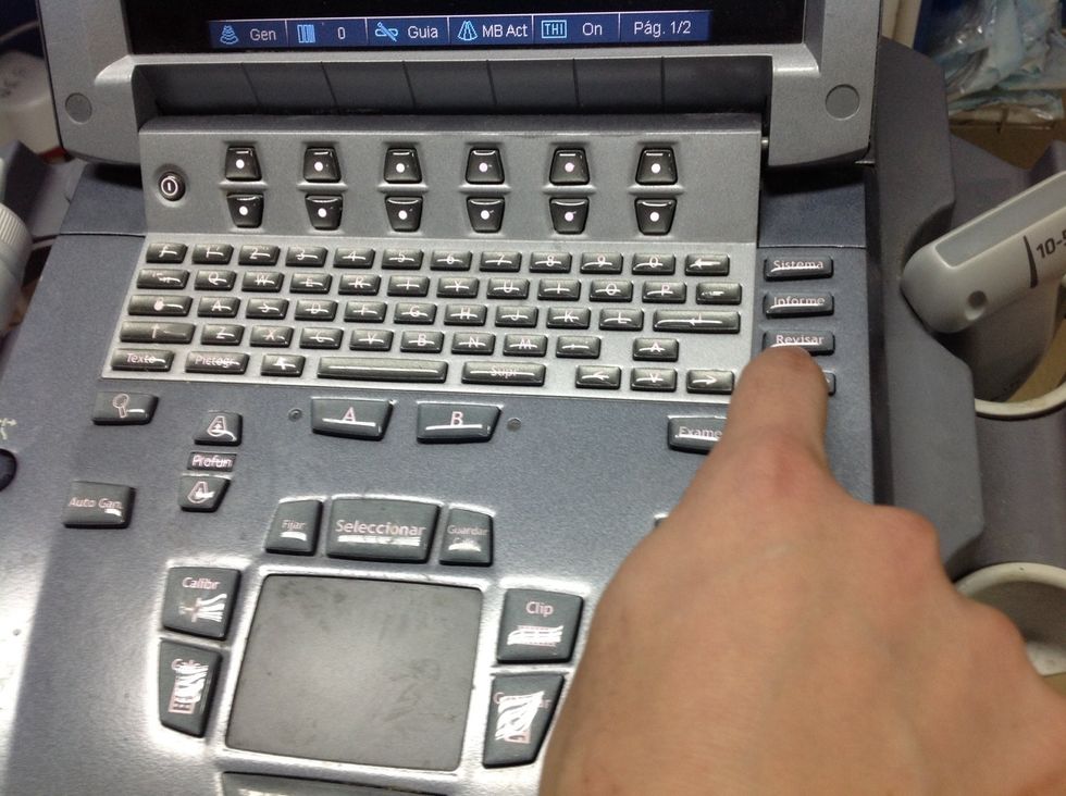 Apretar bot\u00f3n "Revisar"