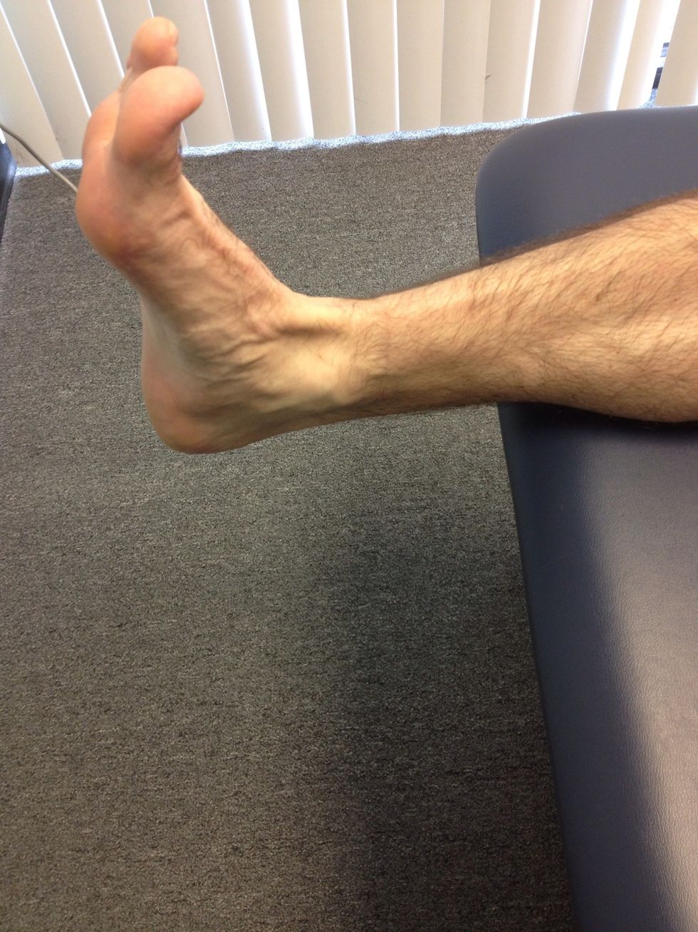 Be sure to have the athlete maintain a neutral ankle position through the duration of taping to reduce incidents of blisters or cuts from tape.