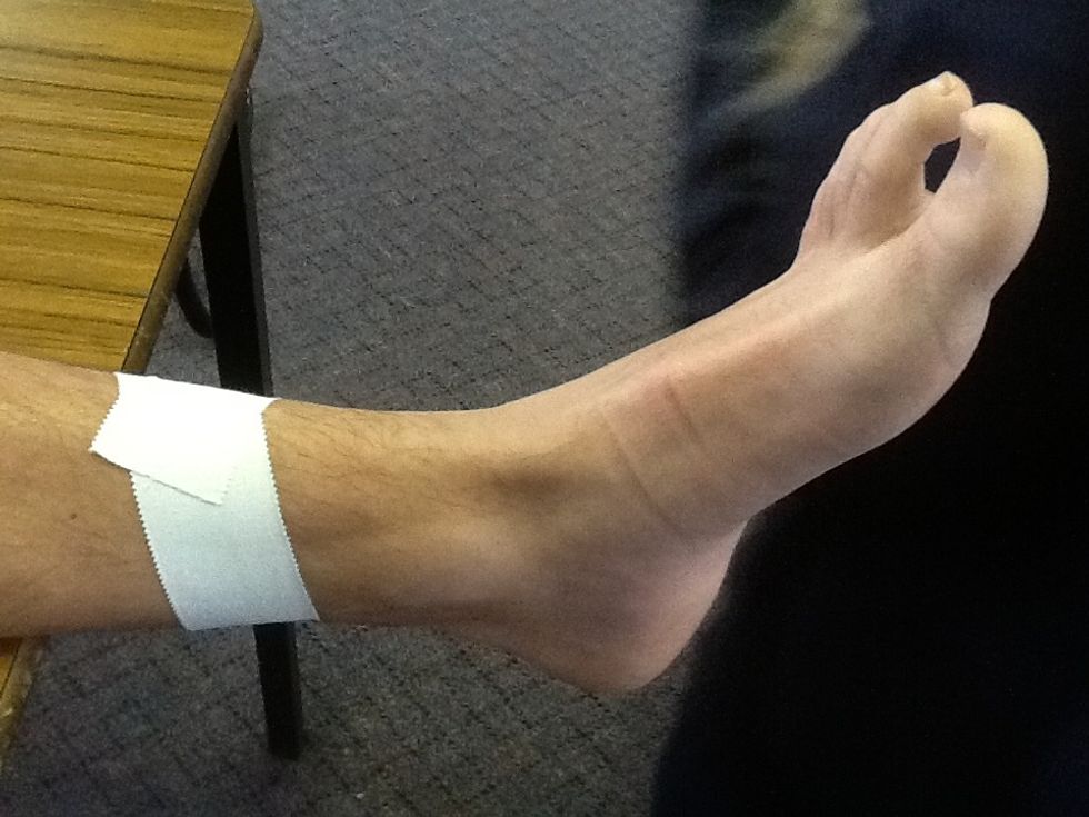 Begin with a simple anchor. Remember the ankle is not a perfect cylinder.