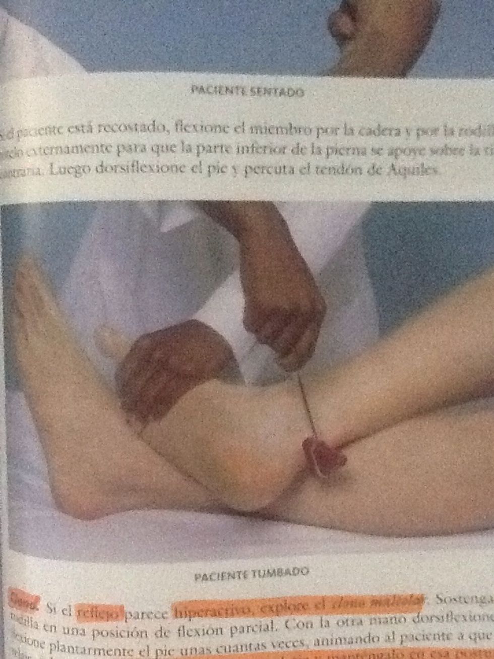 Clono  Explorar el maleolar, dorsiflexionando el pie y  mantenerlo en esa postura. Explore y palpe las oscilaciones entre dorsiflexion y flexi\u00f3n plantar