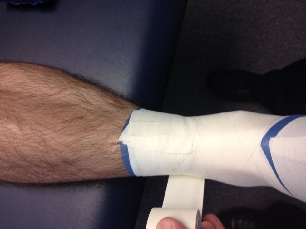 Close: close the exposed ends of supporting strips with anchors and horseshoes down the entire ankle ending at the foot.