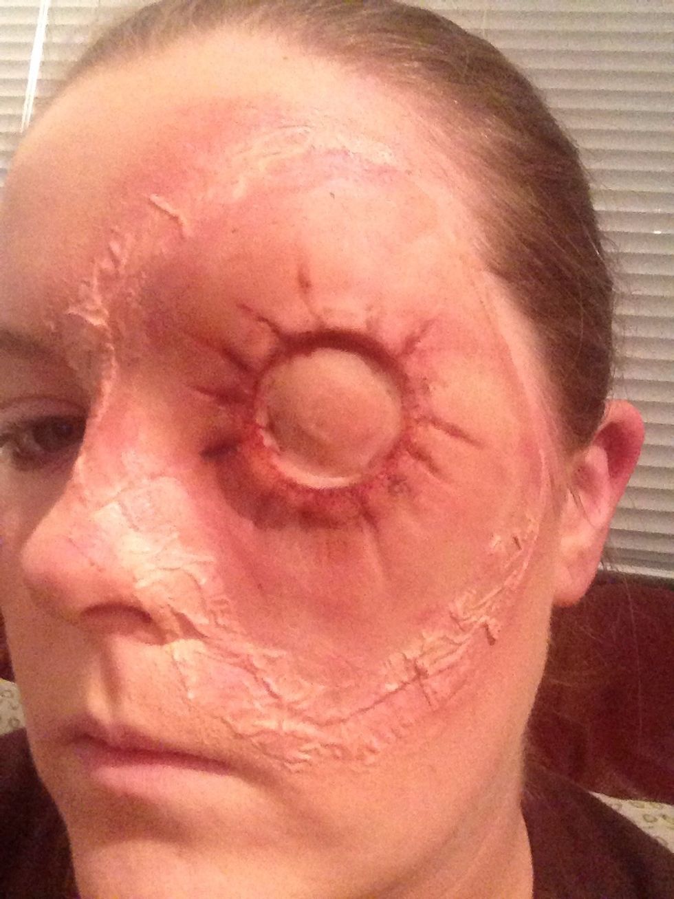 Cover with foundation or facepaint to match your skin