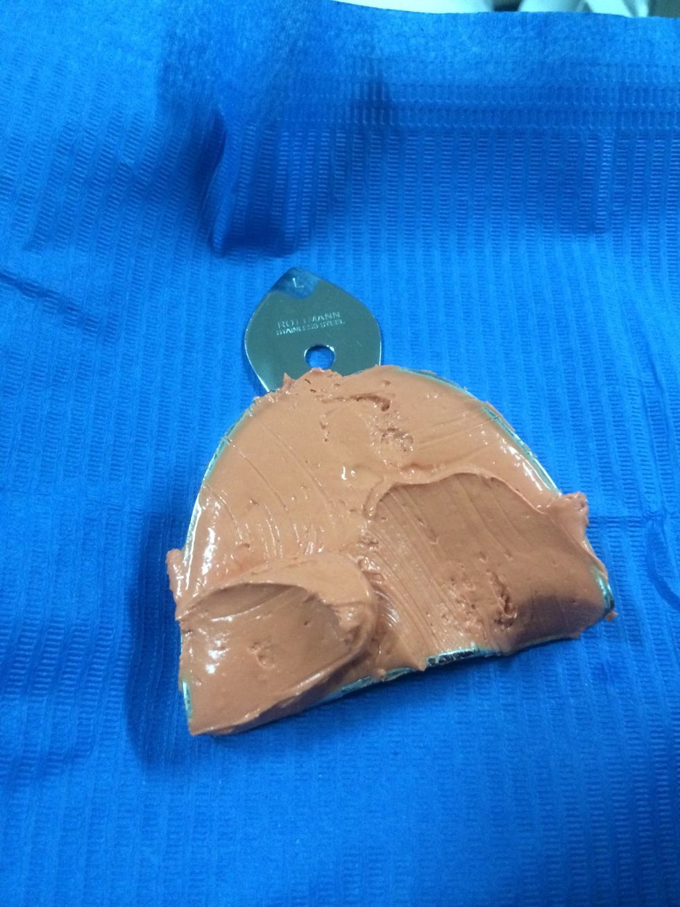 Cubeta cargada con alginato