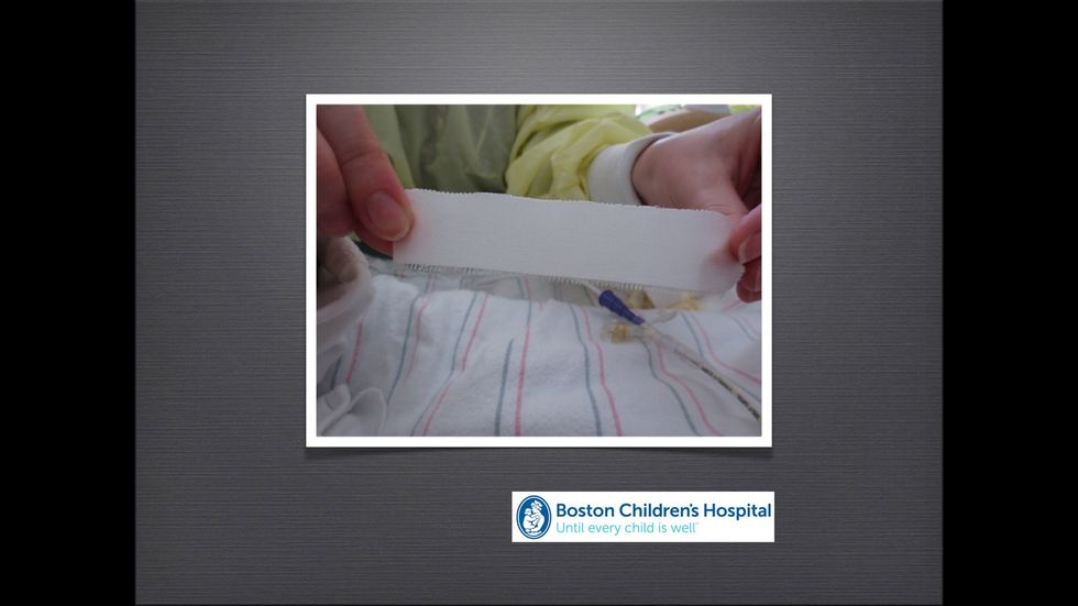 Cut a piece of medical tape about 5 inches long.