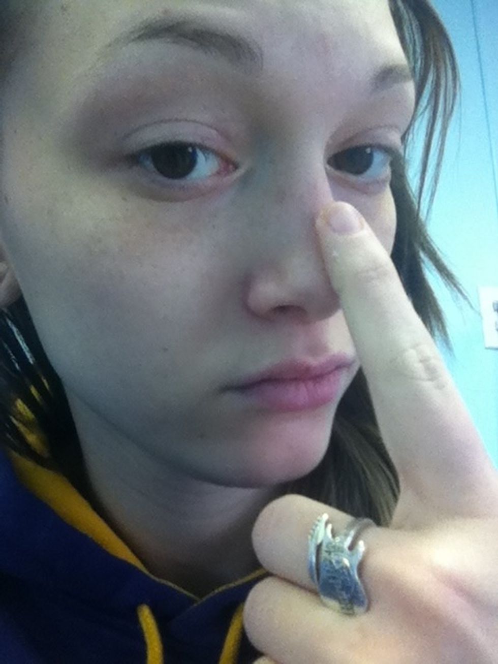 Dab on your nose (or chin) generously.