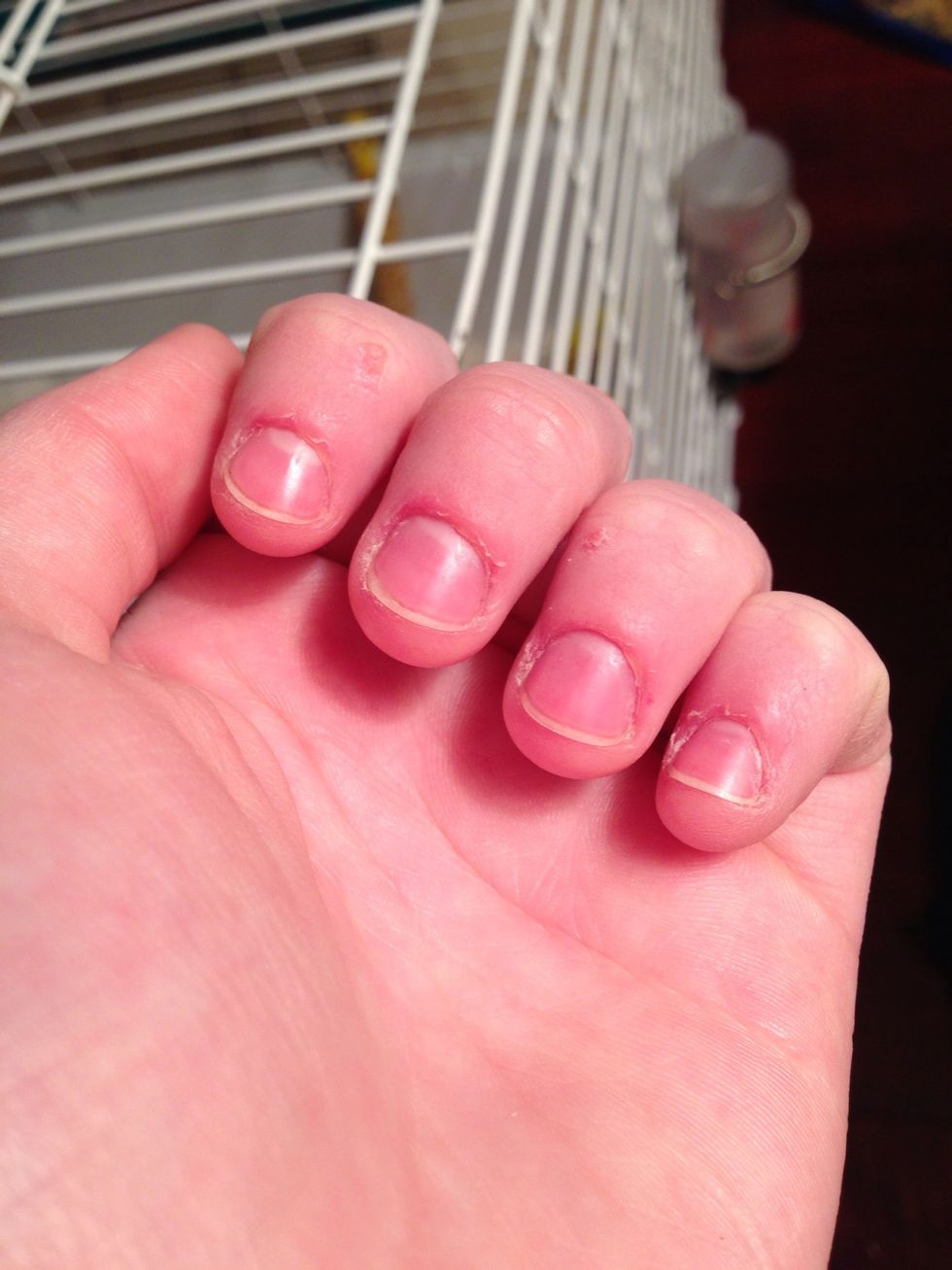 Day 7. What a difference! Moisturizing the nail and cuticles is healthy! Do this as much as you'd like! Also, nail hardener is another good idea! Apply two coats