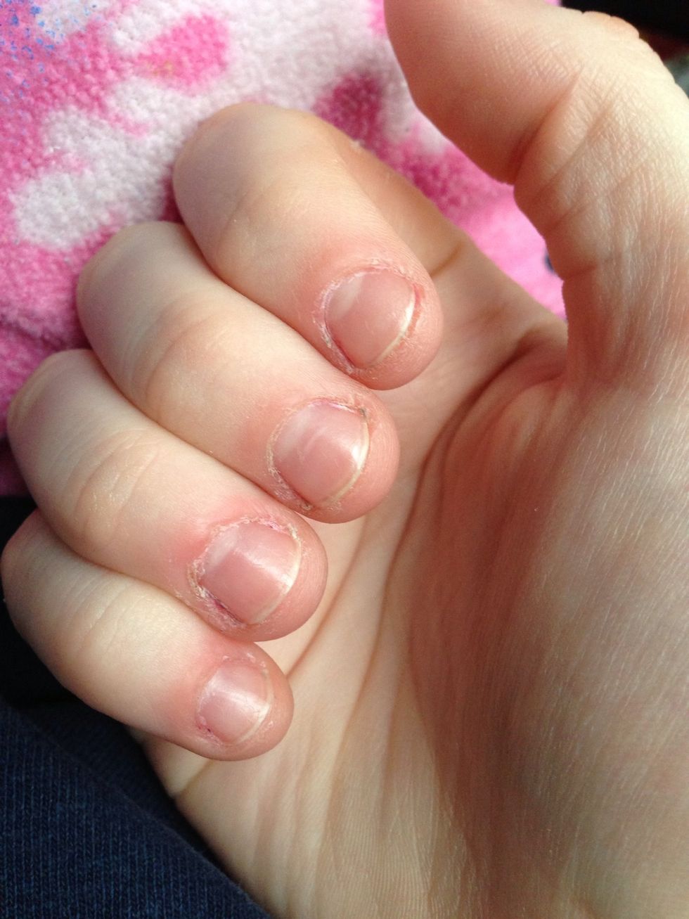 Day five. Your cuticles will no longer grow out like before, as they do not need to protect the nail anymore. Buffing will get rid of ridges and smooth out the nail. Do this once a month.