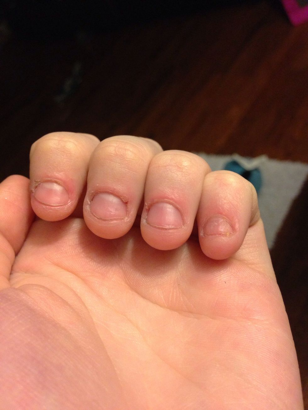 Day one. Nobody wants to have these nails. Biting is usually caused by anxiety or stress.  Recognize WHEN you bite your nails and WHY.