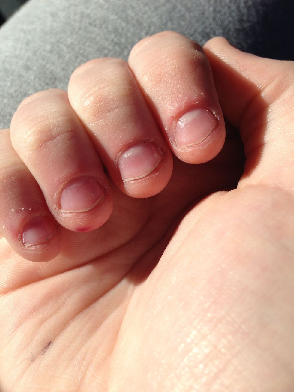 Day two. Like I said, results are visible almost the next day.  When you recognize what makes you bite, pay attention and avoid biting. Improvements will also make you proud and will help.