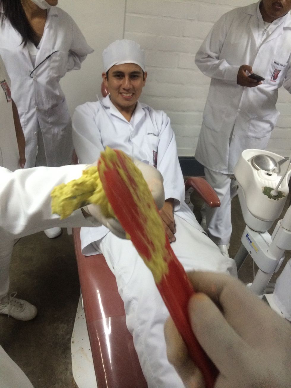 Deslizando la espatula sobre los bordes de la cubeta para que el alginato quede en su interior