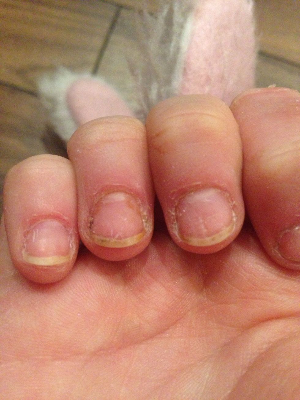 How To Fix And Grow Out Bitten Nails B C Guides