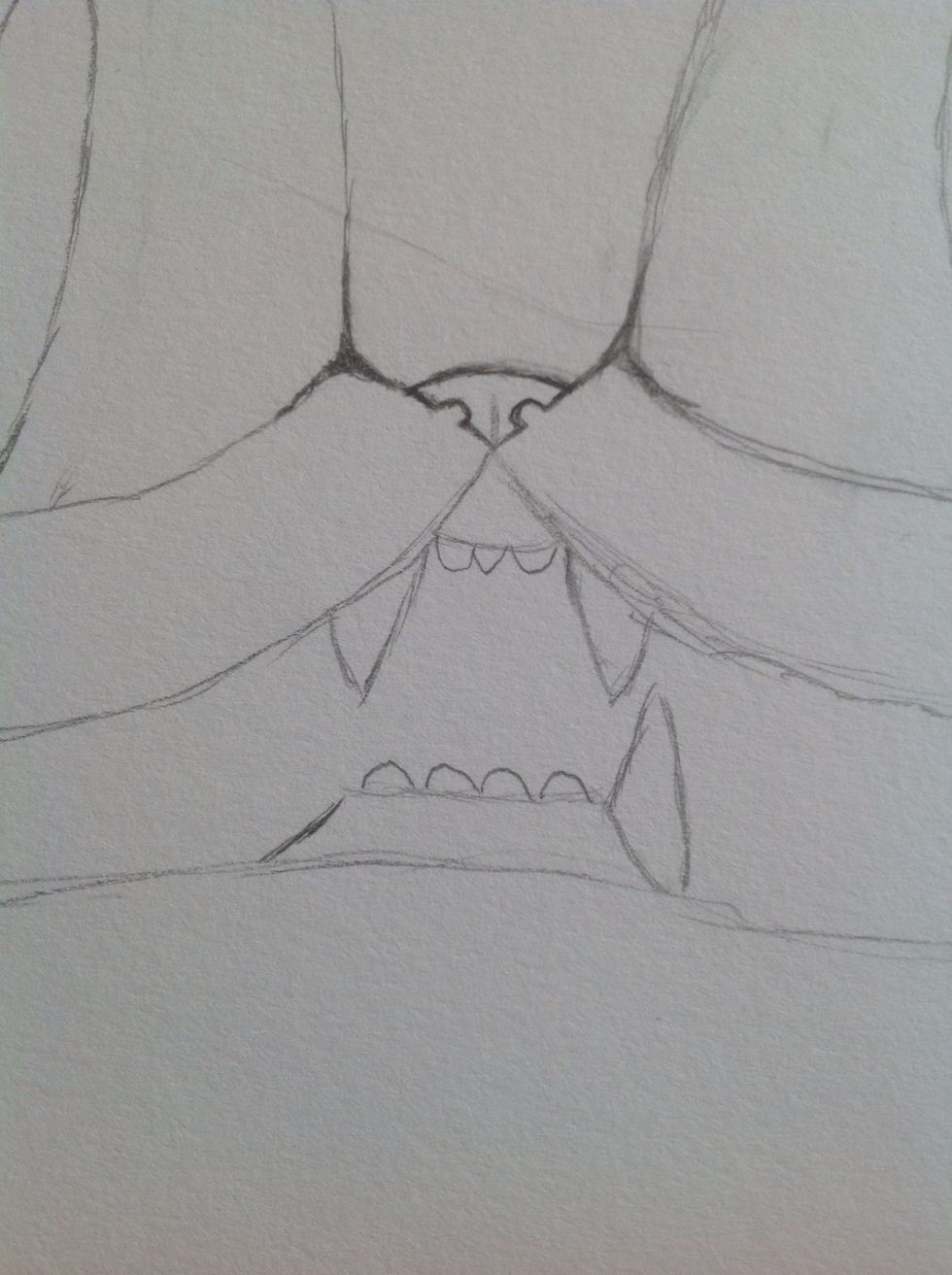 Do the same in the lower jaw.