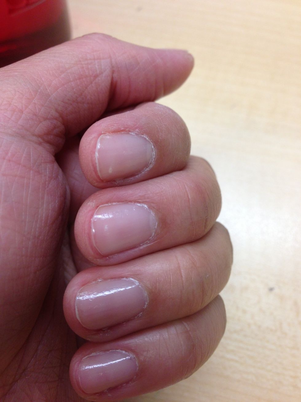 Done! That's after application of Nail Strengthener (OPI Nail Envy) and no manicure done. All smooth. \ud83d\ude09