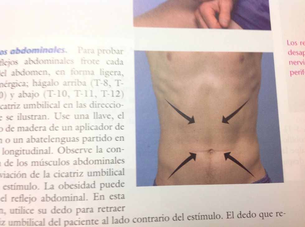 El reflejo abdominal nos ayuda para ver que t8,t9,t10 y t11 est\u00e9n intactos. Se debe frotar como dice la imagen y debe haber una contracci\u00f3n de los m\u00fasculos abdominales.