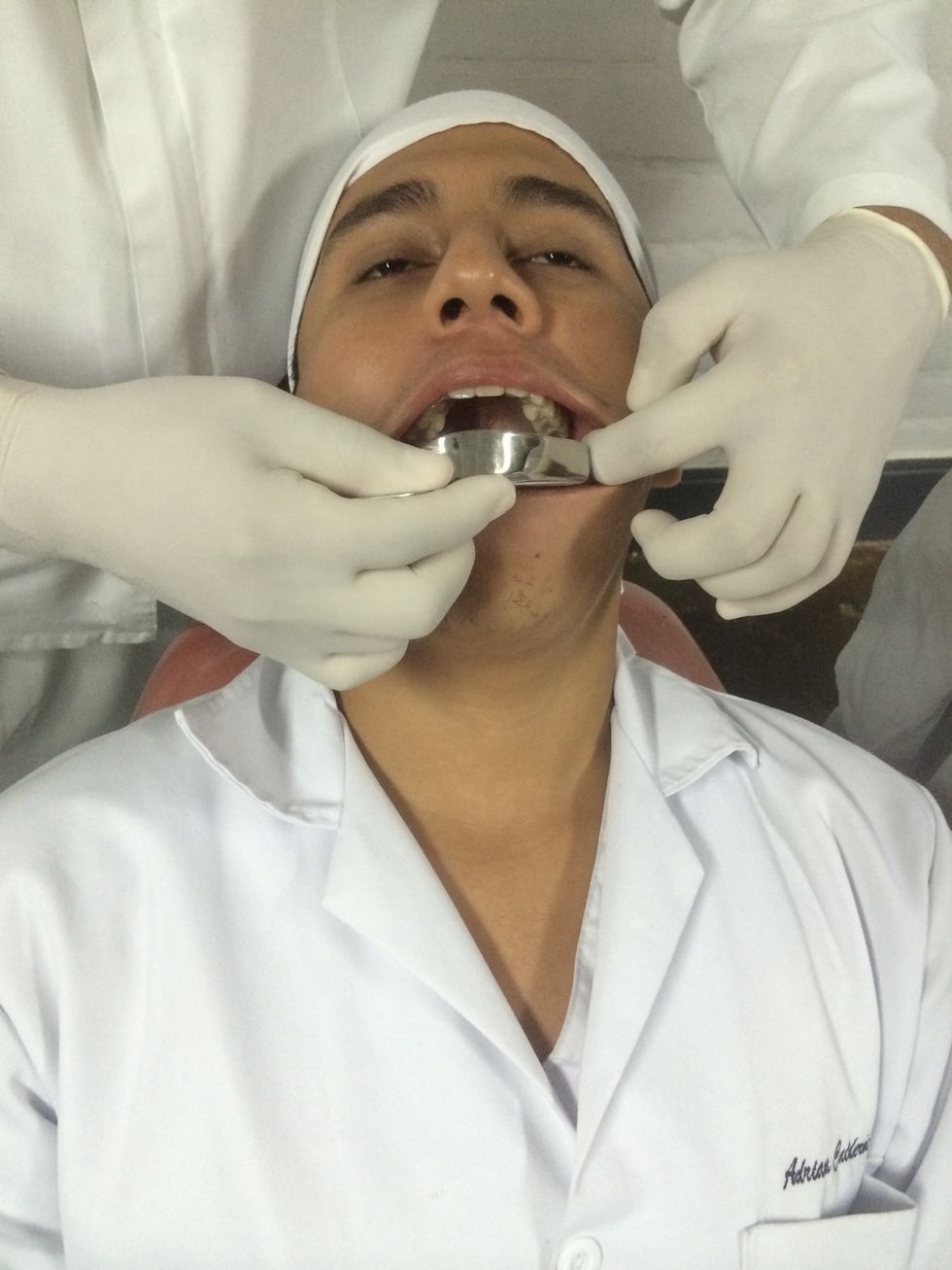 Elija una cubeta que quede holgada en la parte mas distal de la arcada. Una cubeta muy peque\u00f1a causara dolor en la zona vestibular de molares