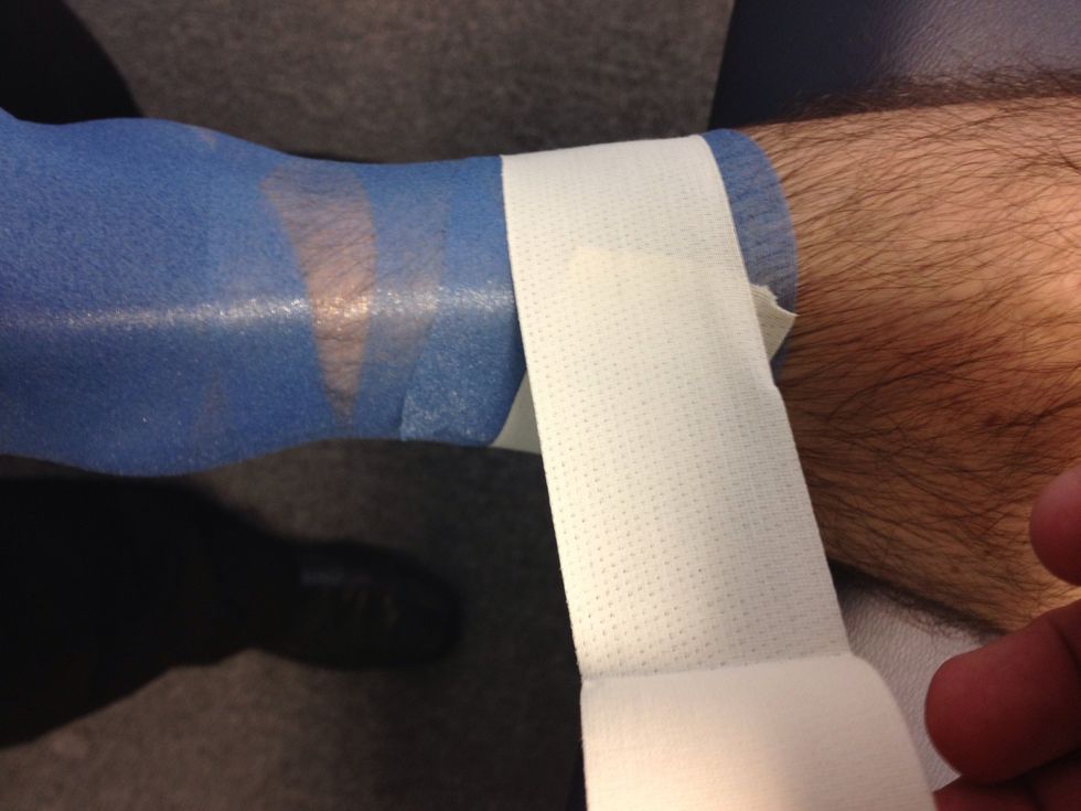 End of first top anchor.