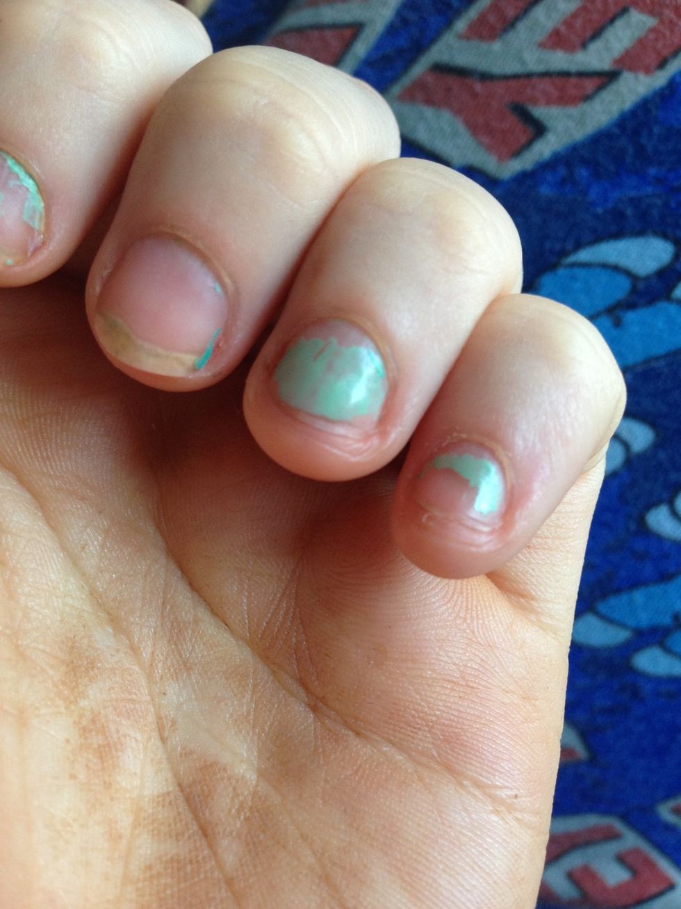 Everyone has their day, right?? In didn't hurt the nail bed, so that's good. Just suffered from a very bad sequence of anxiety attacks and couldn't help it. But guess what? THEY'LL GROW BACK ^.^