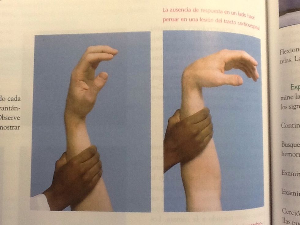 Examine tono muscular  Levanta el antebrazo hasta una posici\u00f3n vertical  Baje despu\u00e9s el brazo unos 30 a 45 cm y d\u00e9jelo caer, observe como cae  Un brazo normal cae de forma lenta