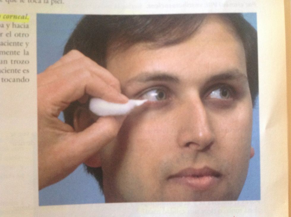 Explorar reflej\u00f3 corneal