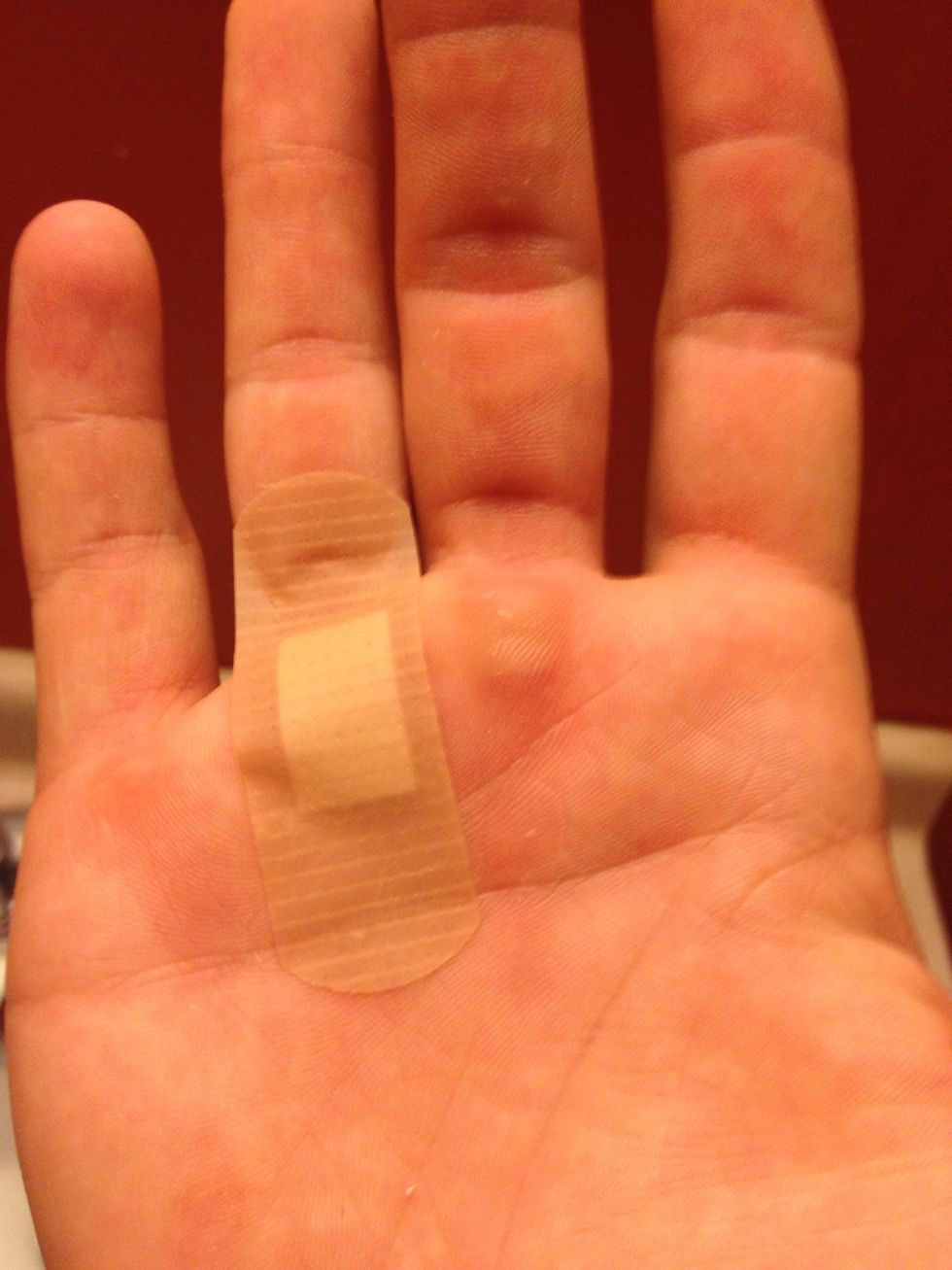 How to heal ripped callous hands B+C Guides