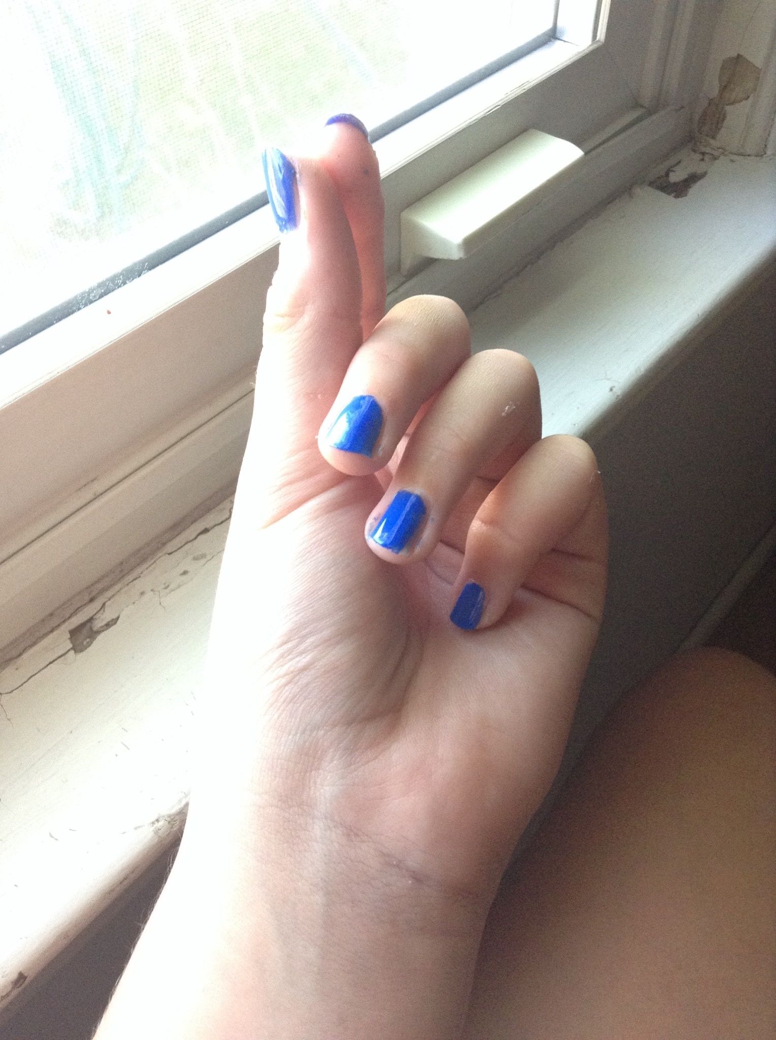 misshapen finger nails