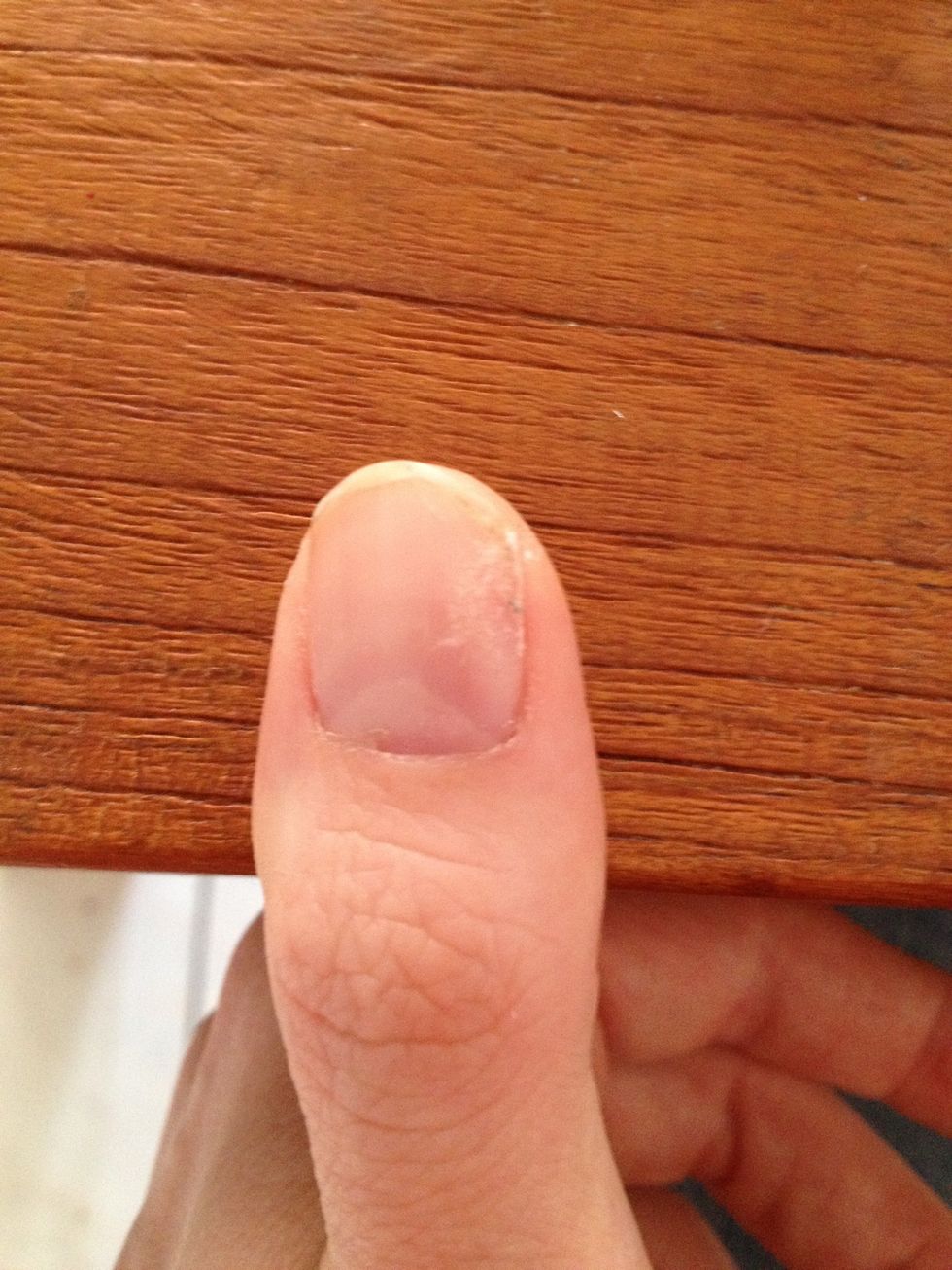 How to repair a tear in your nail 💅 B+C Guides