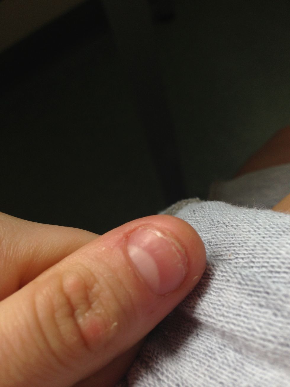 How to fix and grow out bitten nails B+C Guides