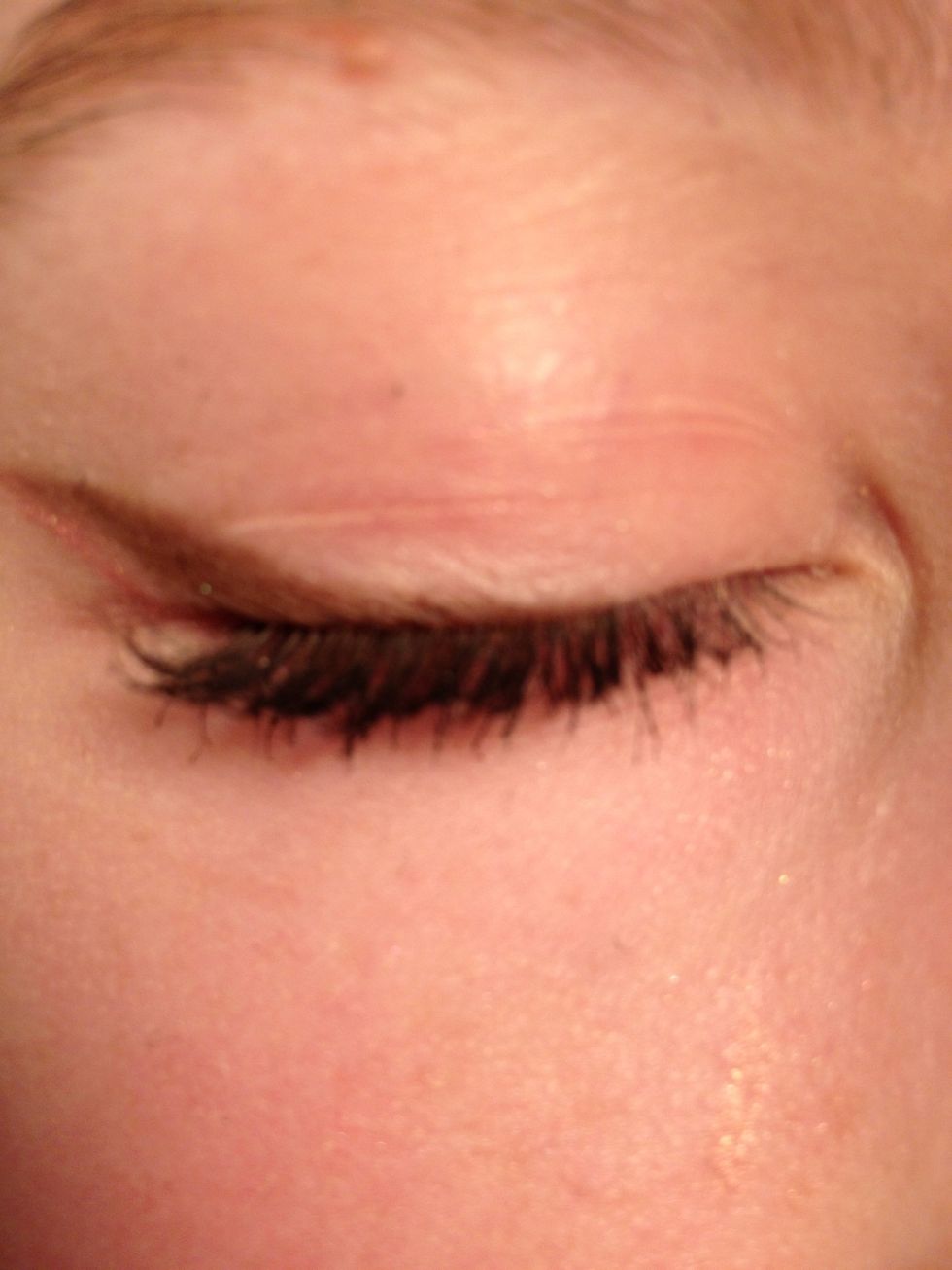 Eye closed.
