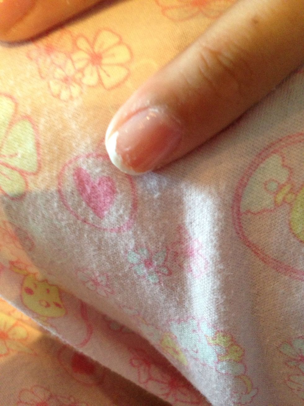 Gently pull the tape off . SLOWLY!!