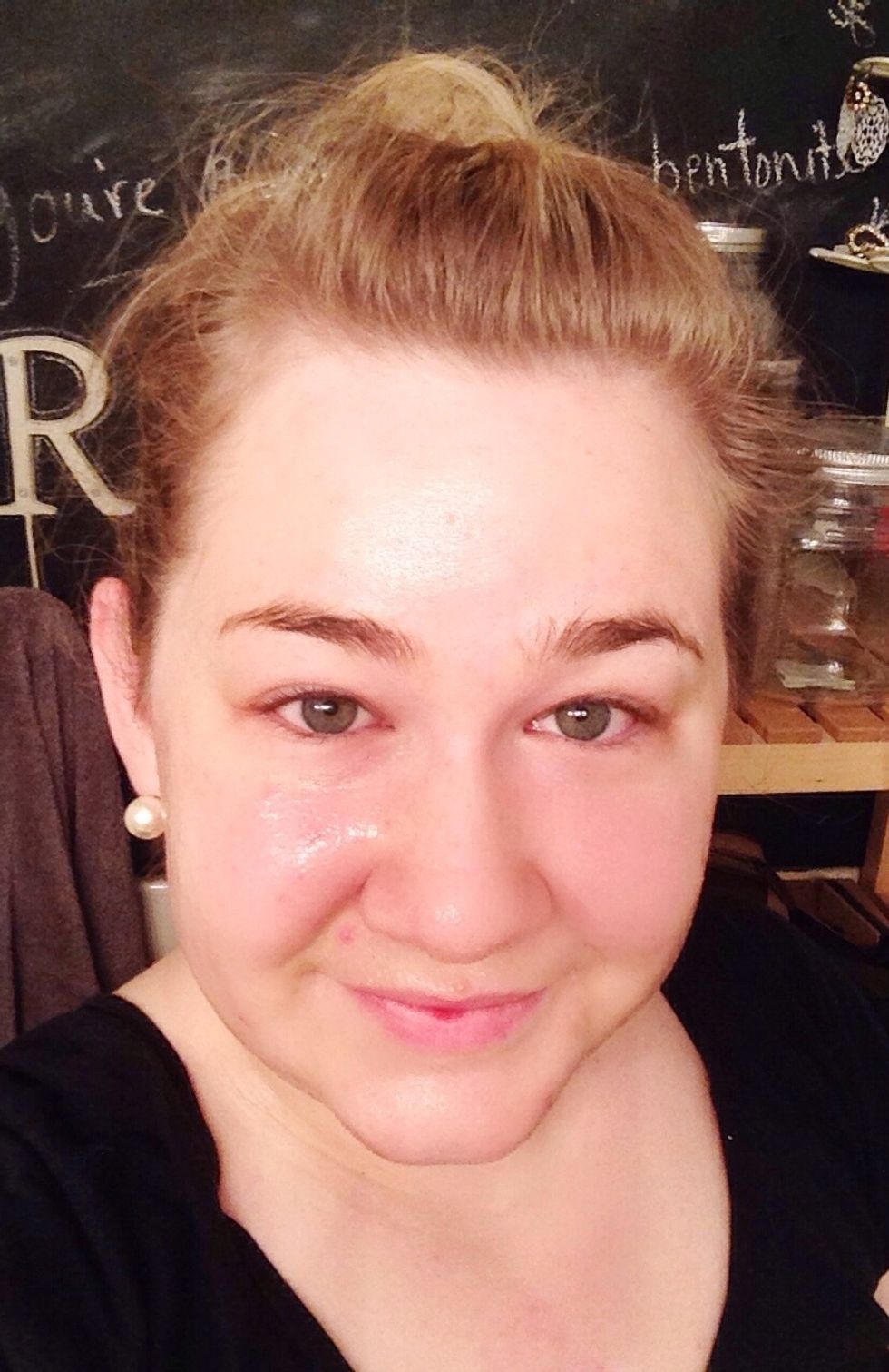 Gently run into face focusing on problem areas.