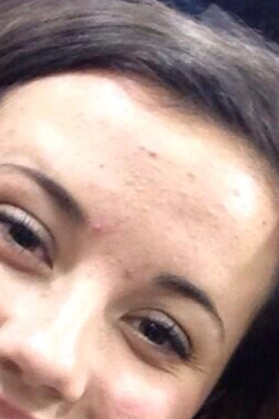 Gross i know, but this is the before