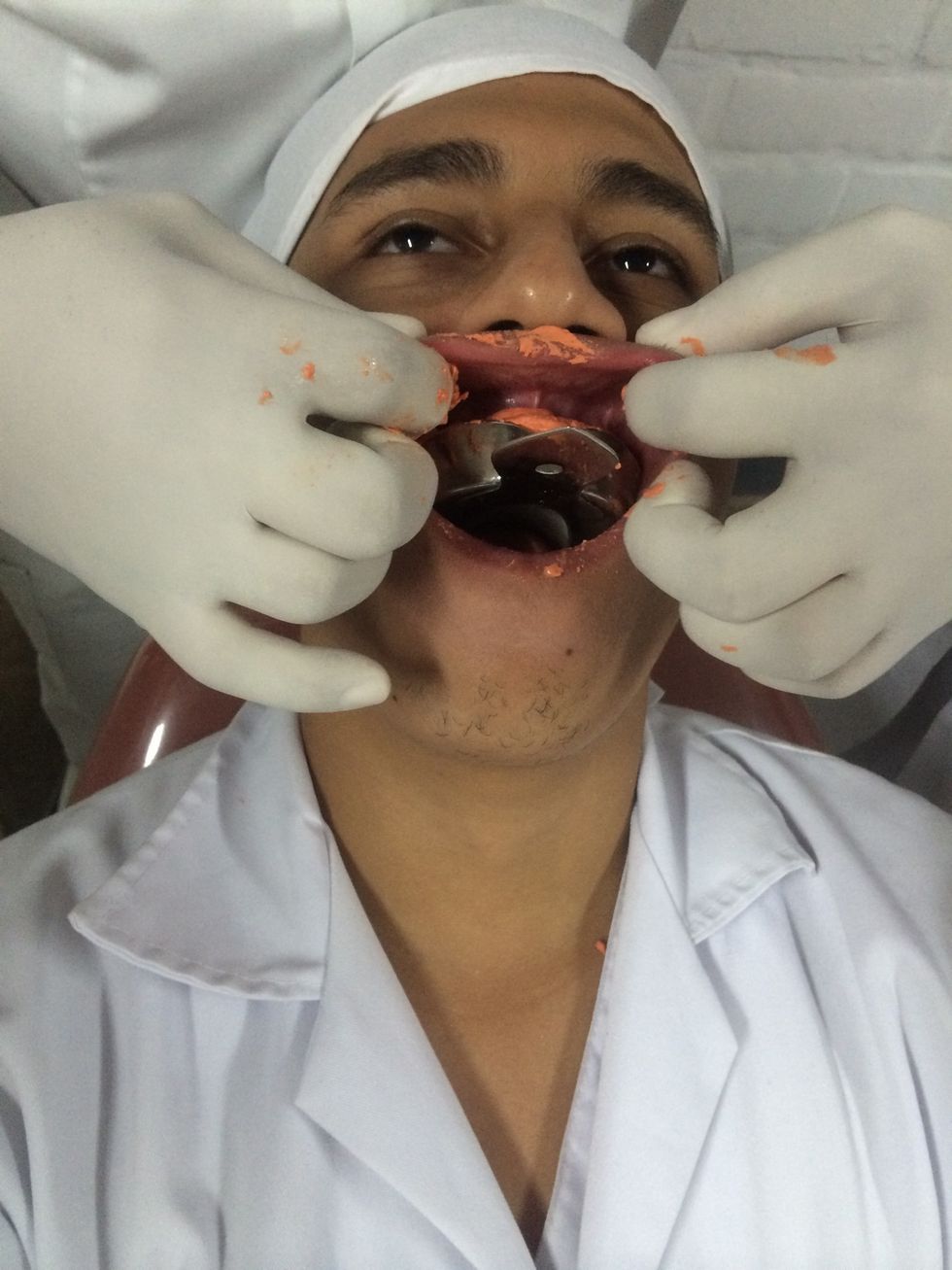 Haga ingresar la cubeta por un lado y girandola. Aplique presion inicial en ambas zonas posteriores y continue hacia anterior, levantando los labios para que el alginato fluya hasta el fondo de surco