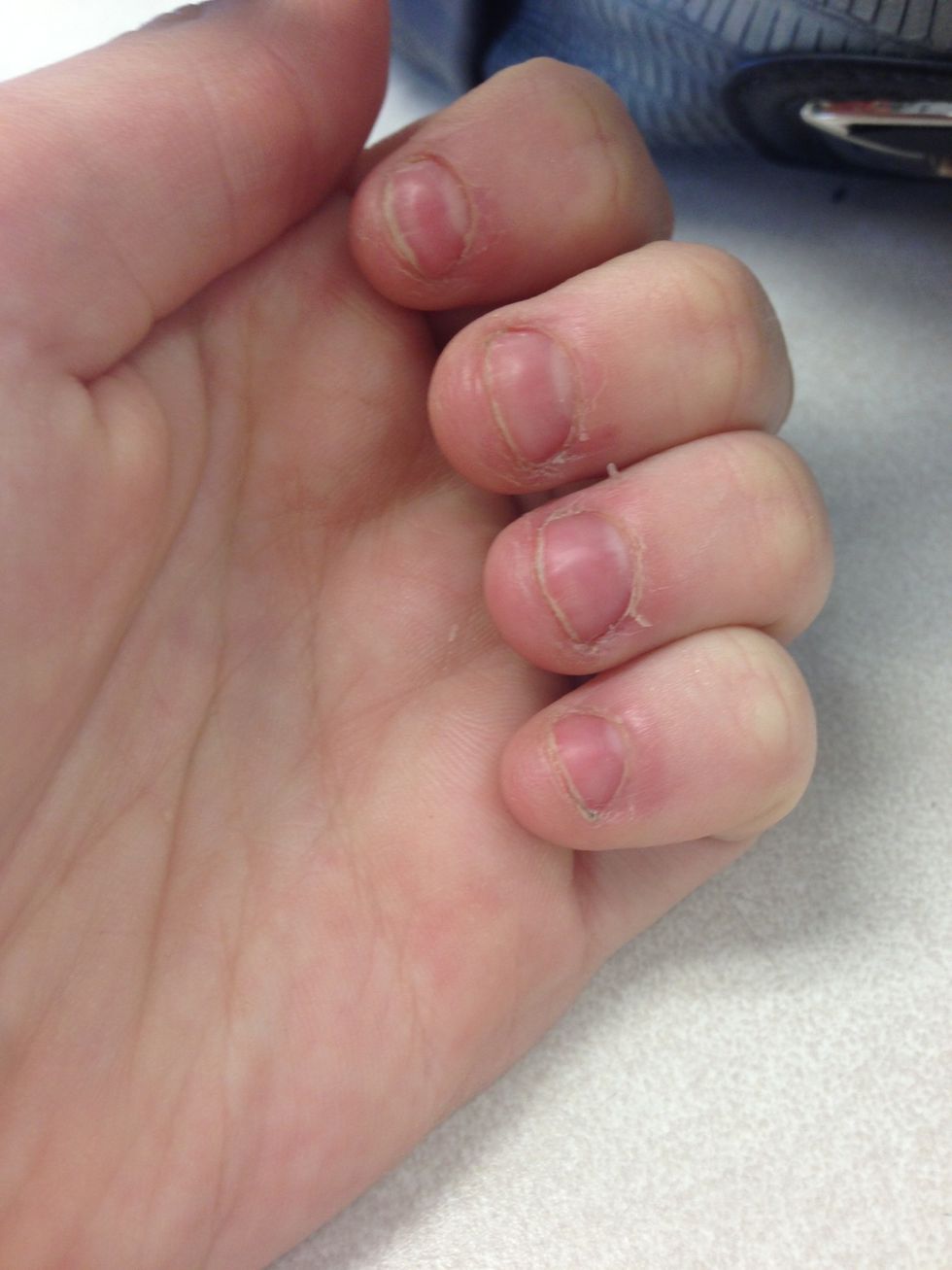 I am embarrassed of my nails. I've bitten ever since I can remember. It's the hardest thing to stop. But there is good news!