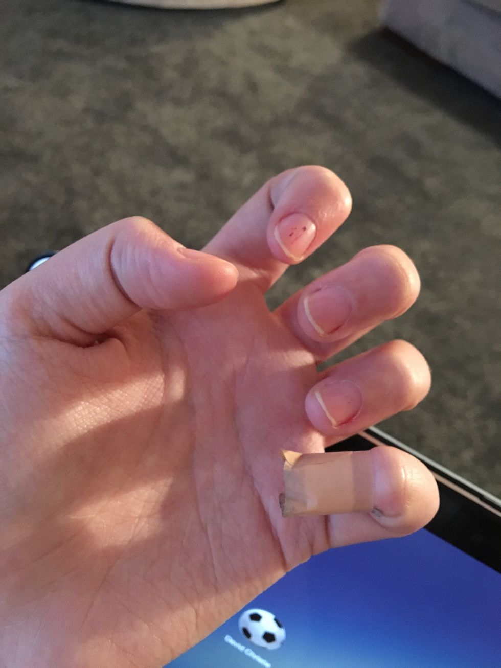 I bit the skin around my pinky and its gone all sore. Number 1 tip! Keep the skin, and your nails, out of your mouth! \ud83d\ude02\ud83d\ude44