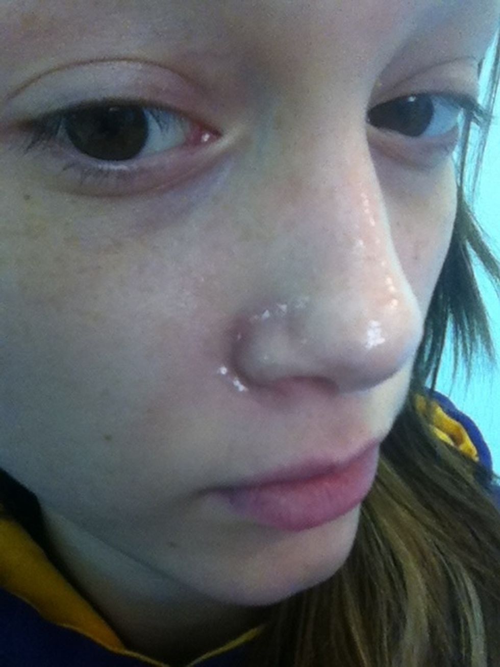 I have a few blackheads in the creases of my nose and on top of my nose. Make sure the amount of glue is thick and even. Let it air dry completely!