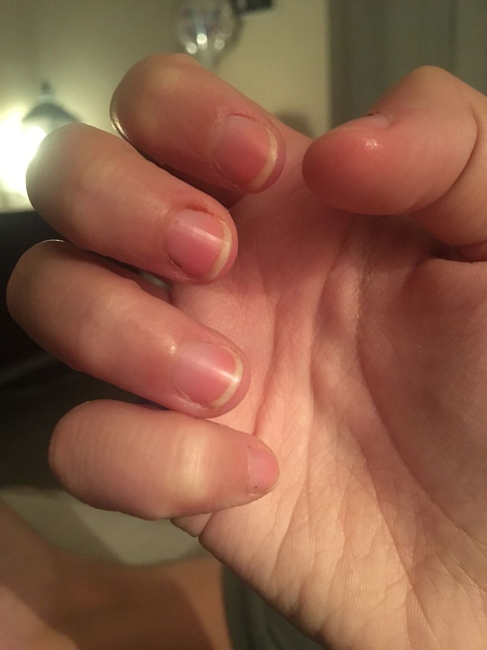 I have gorgeous white edges on my nails now and they are easy to paint. I keep pushing back my cuticles and applying the growth formula at least once a week.