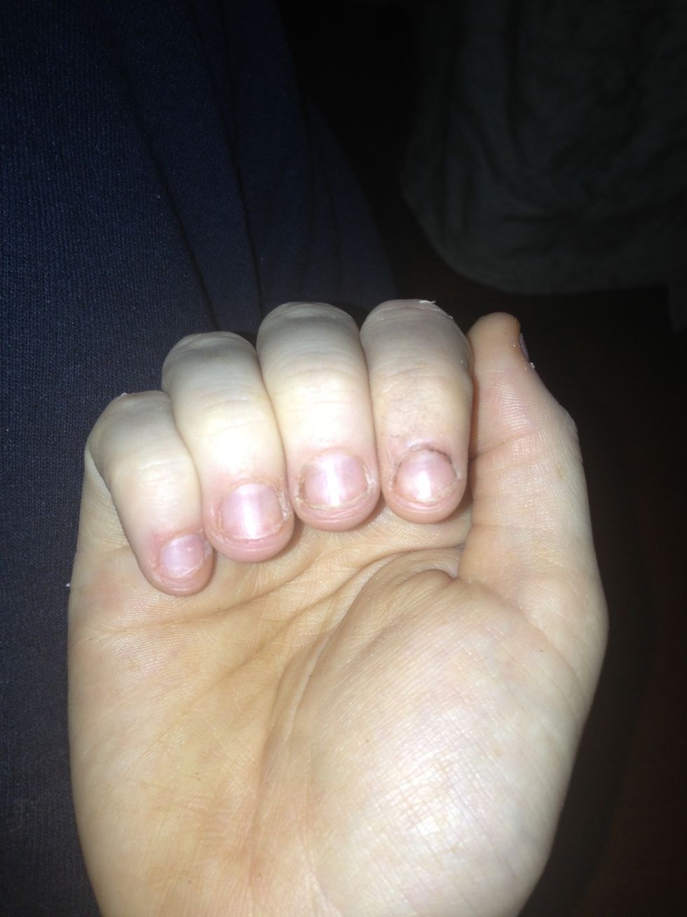 I relapsed everyone. Trying again!!! Each time I go longer! Keep up the good work everyone