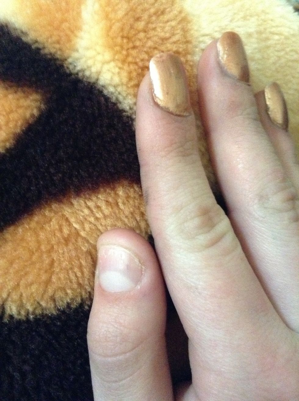 If nail falls off clean the nail