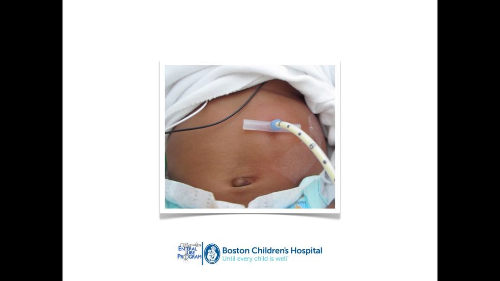 If you think the bolster is too tight call the GI department.