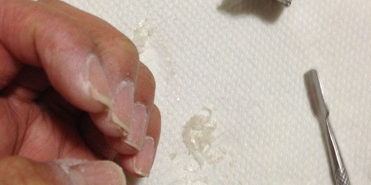 How Do You Remove Shellac From Fingernails