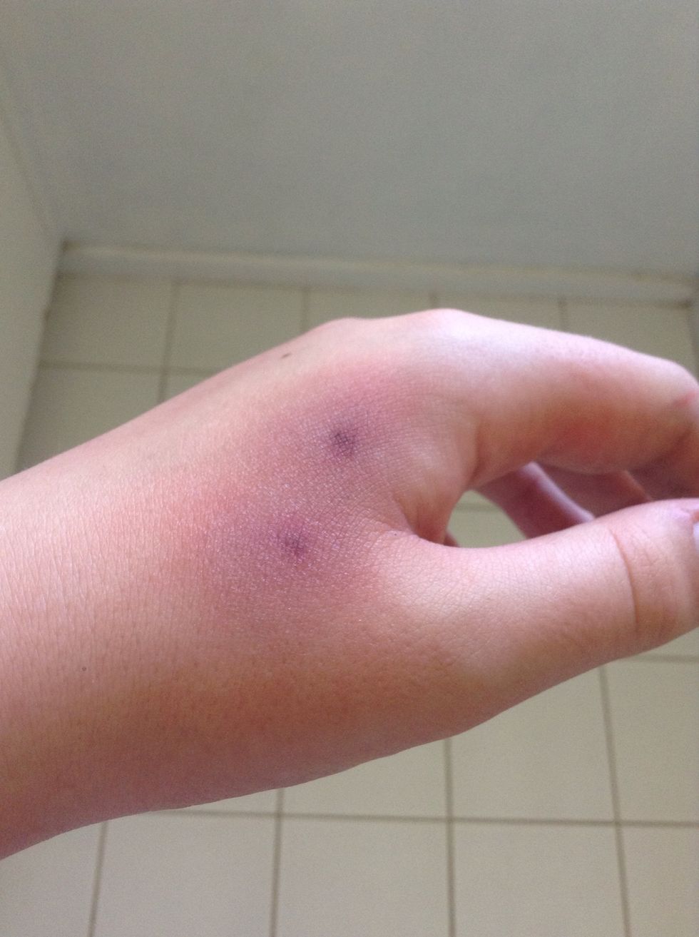 How to make a fake bite wound B+C Guides