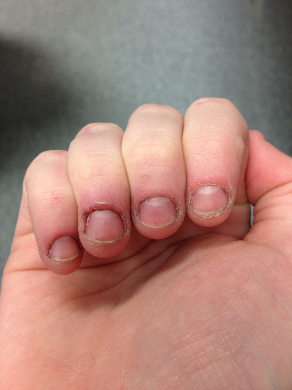 How to fix and grow out bitten nails B+C Guides