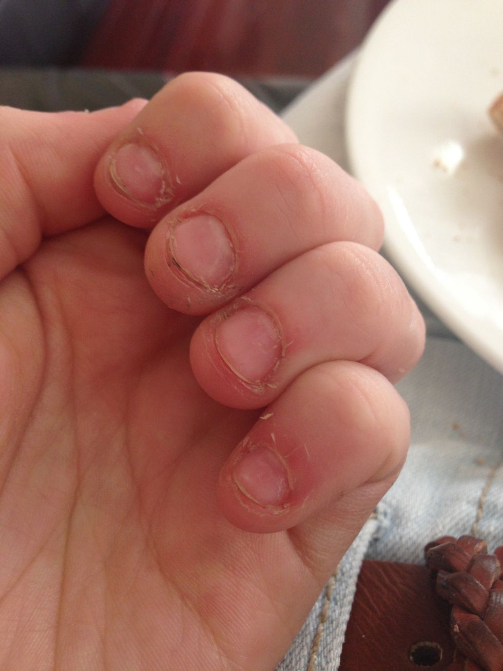 How to fix and grow out bitten nails B+C Guides
